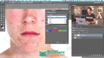 Photoshop祛痘祛斑打造完美肌肤视频教程